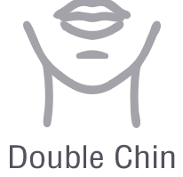 Double Chin