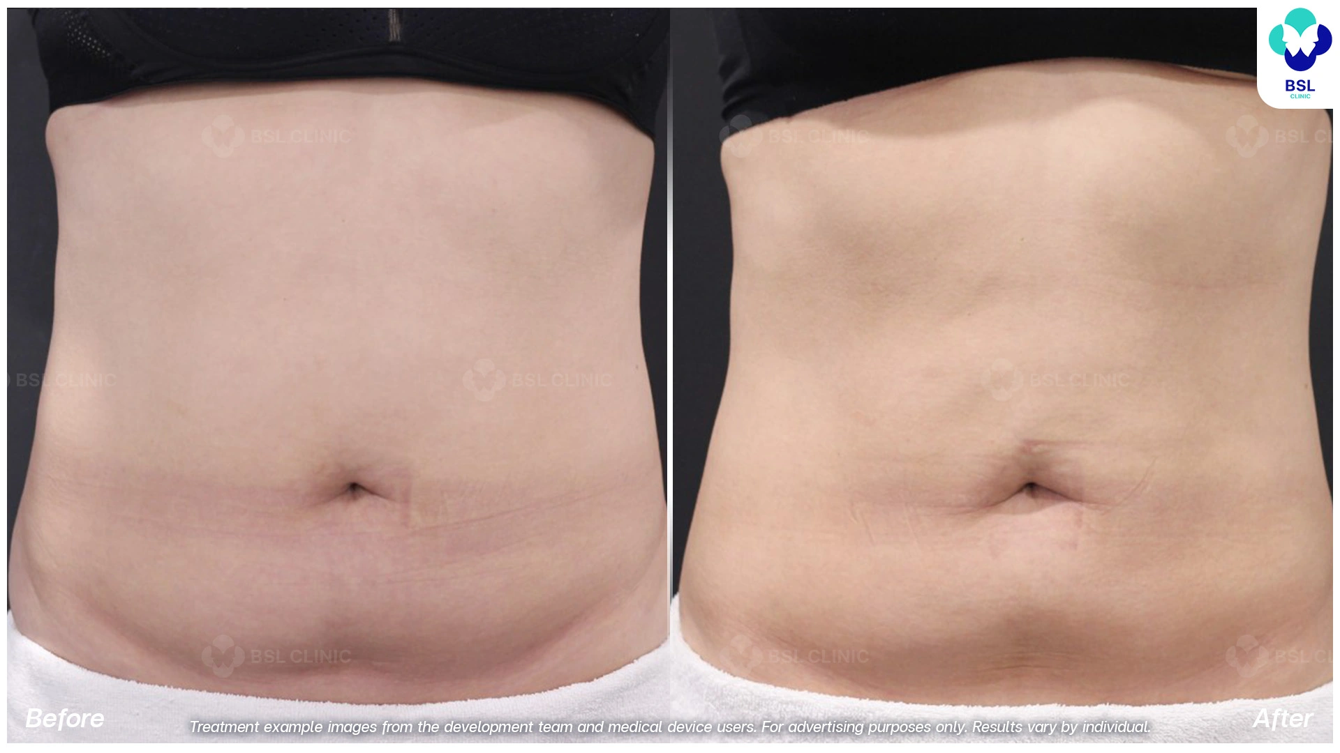 Treatment example images from the development team and medical device users. For advertising purposes only. Results vary by individual.