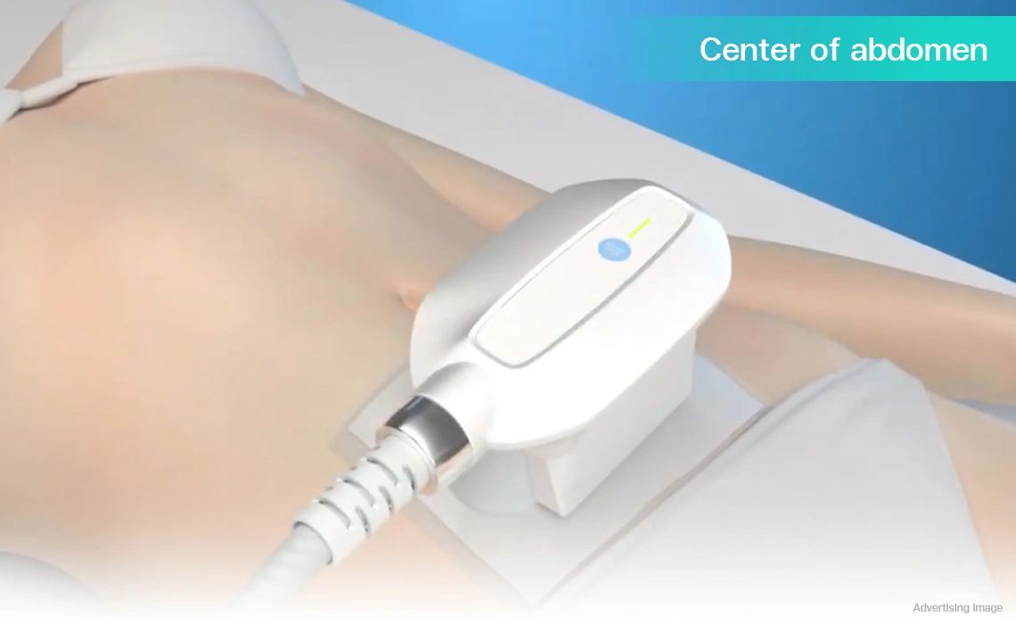 coolshaping fat freezing center abdomen fat reduction treatment