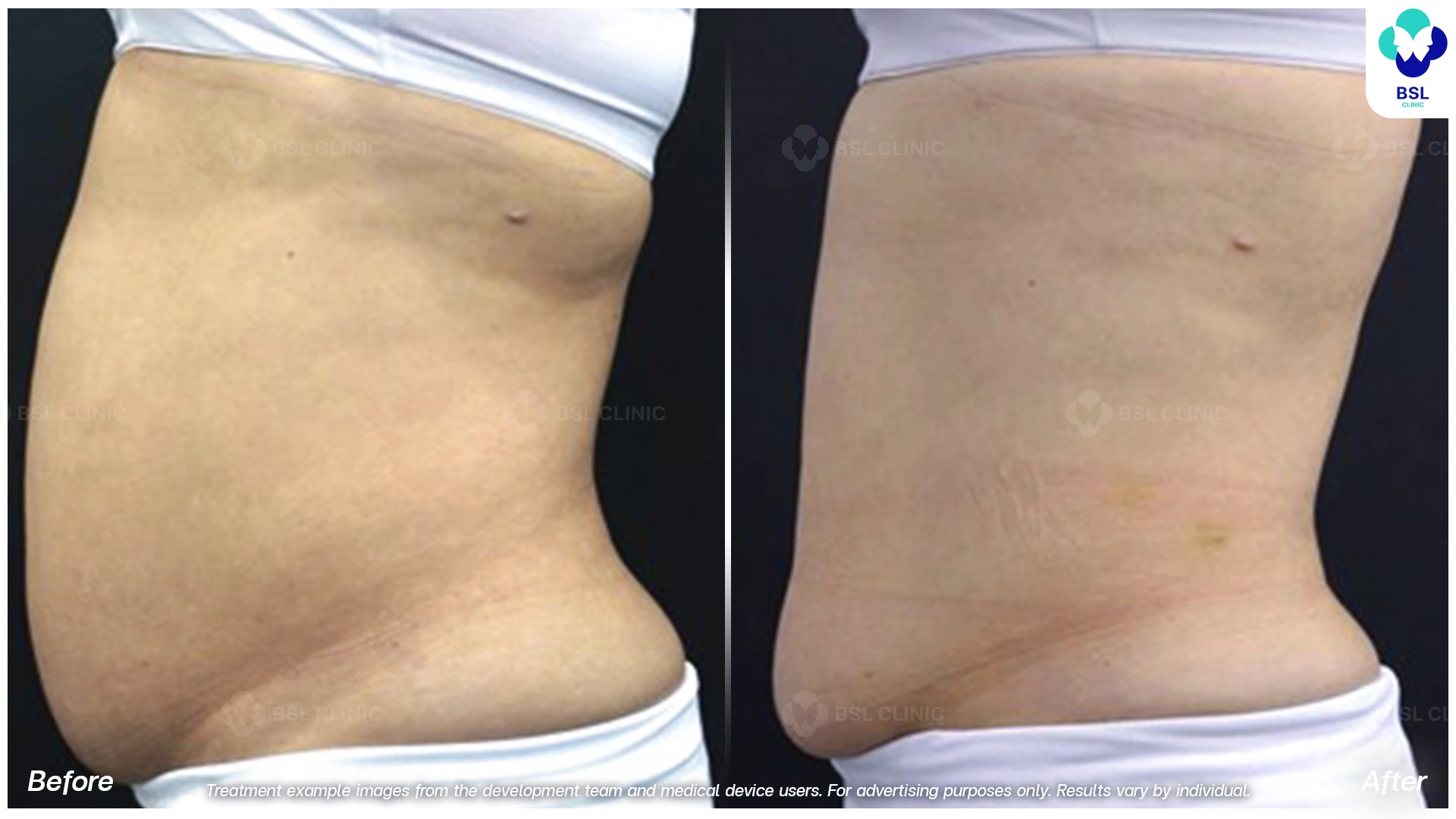 Treatment example images from the development team and medical device users. For advertising purposes only. Results vary by individual.