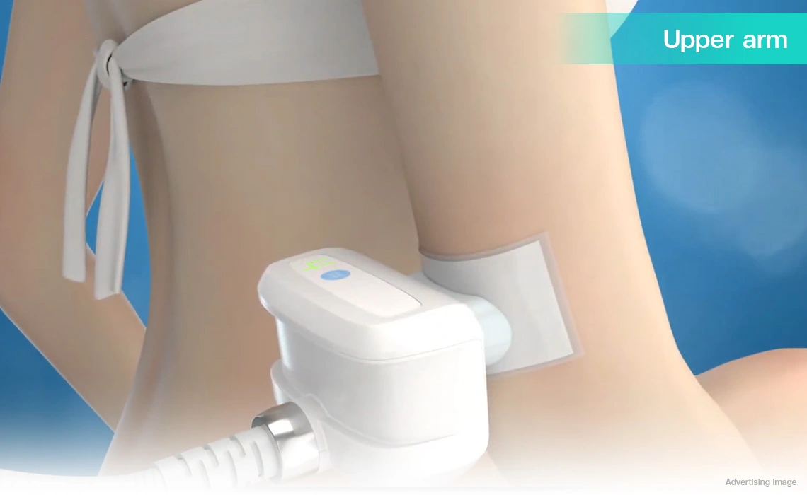 coolshaping upper arm fat freezing treatment for slimmer arms