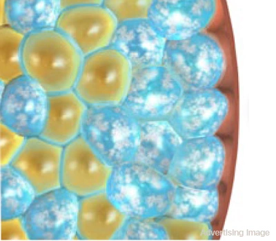 crystallized fat cells undergoing cryo apoptosis after fat freezing treatment
