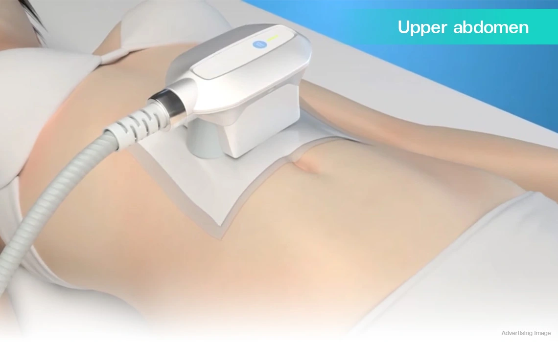 fat freezing upper abdomen treatment coolshaping waistline shaping