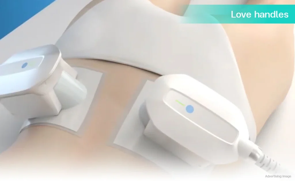 CoolShaping2 fat freezing cryolipolysis body contouring fat reduction CoolSculpting love handles waistline slimming belly fat removal