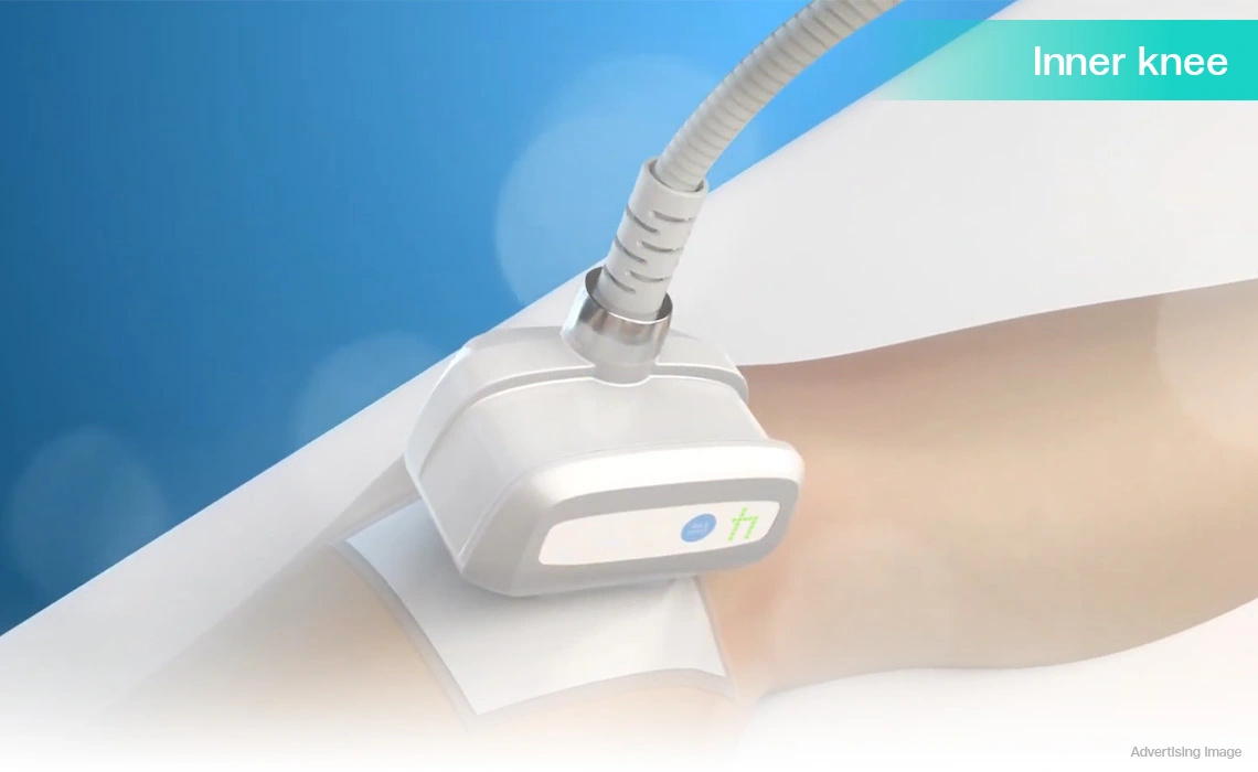 inner knee fat reduction coolshaping treatment for leg contouring
