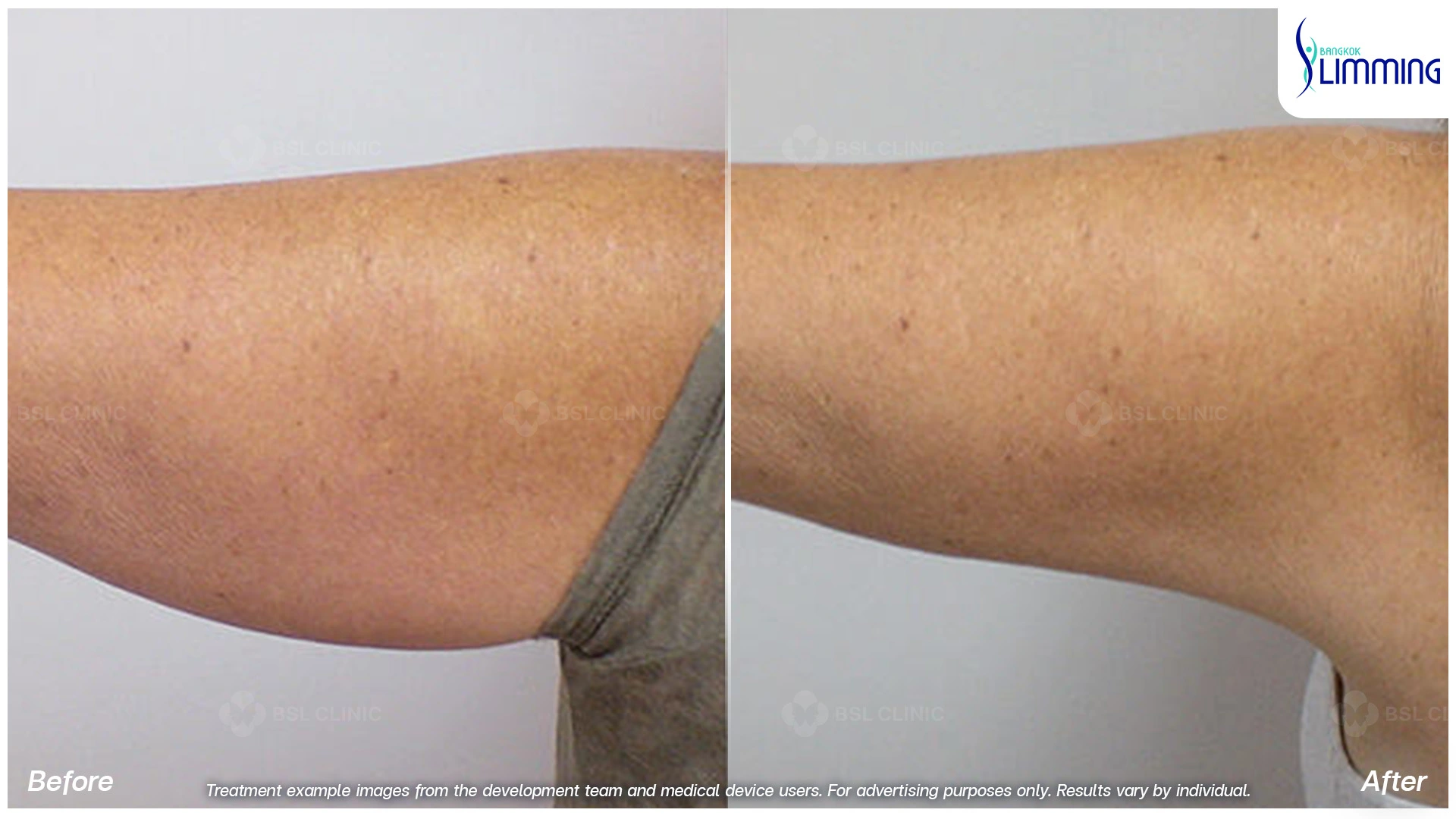 arms result