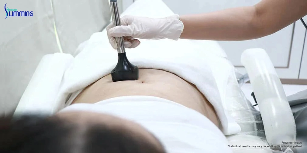 abdomen forma plus