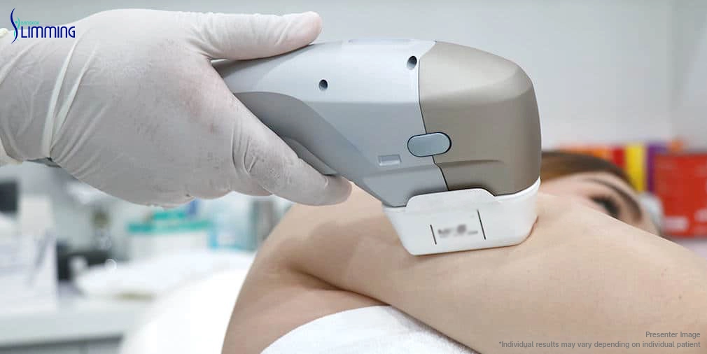 Ultraformer III Body Program