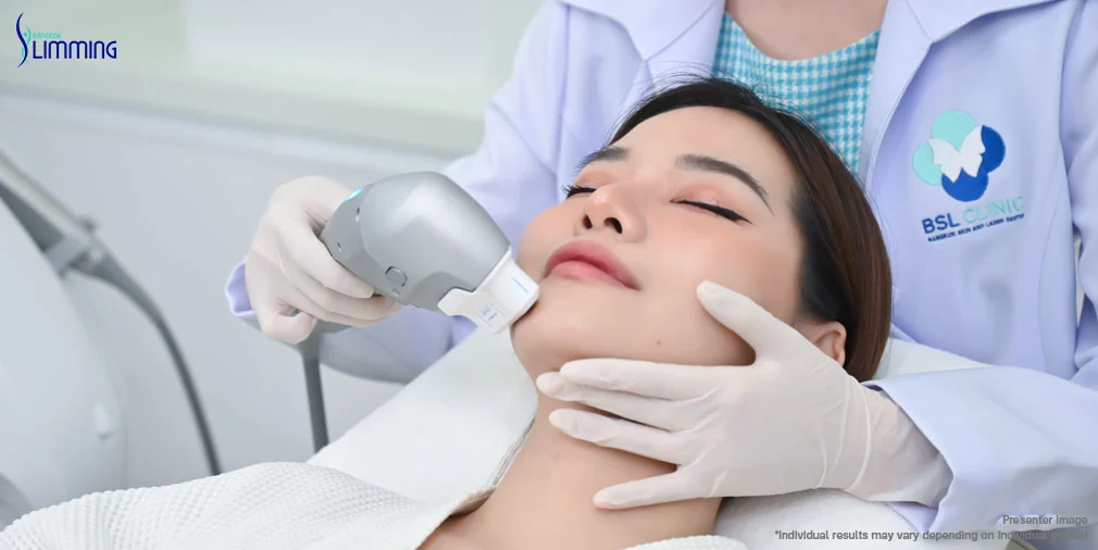 Ultraformer Double Chin